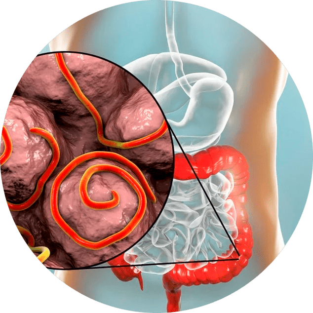 Gastrointestinalni trakt in paraziti