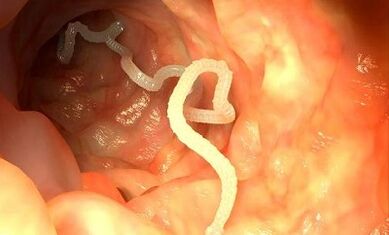 vzroki parazitov v človeškem telesu