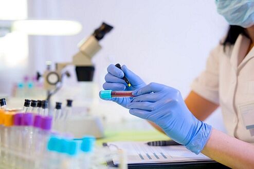 krvni test za parazite